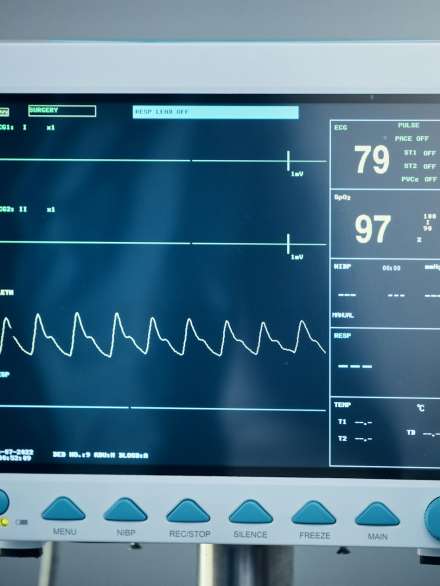 Healthcare, hospital and electrocardiogram monitor or screen. Medical tool, ecg equipment and heart